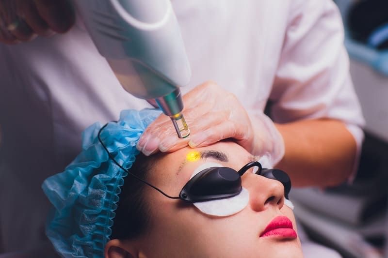 Eyebrow laser removal