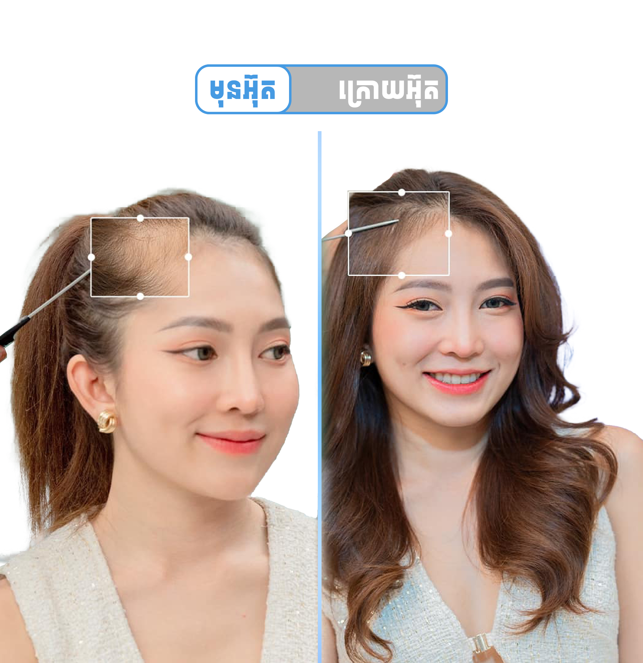 Hairline Perm